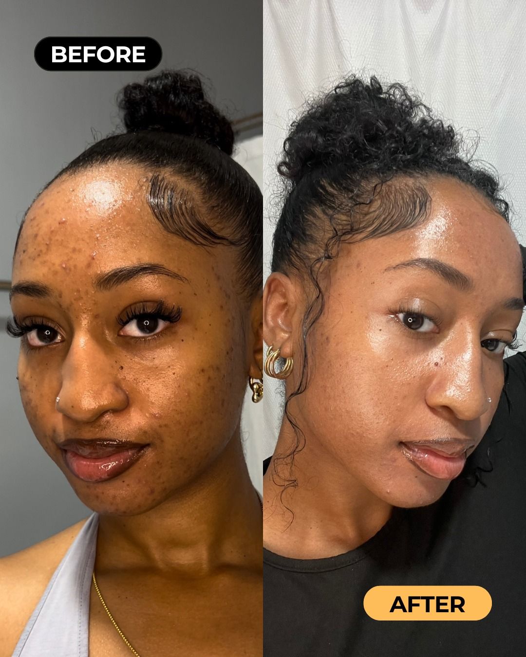Adaeze O. before and after
